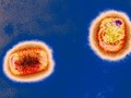 Vietnam se prepara activamente para prevenir la epidemia de viruela símica