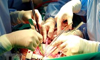 Vietnam sigue progresando en el trasplante de órganos