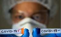 США вышли на первое место в мире по числу зараженных коронавирусом