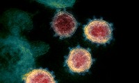  Laporan tentang Asal-Usul Virus SARS-CoV-2 Akan Diumumkan Selama Beberapa Hari Mendatang