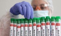 Tiongkok Temukan Flu Unggas pada Hewan Liar