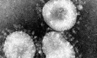  Menemukan orang pertama yang terinfeksi Covid-19 di Afrika