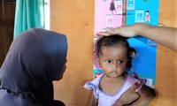 Indonesia Bertekad untuk Mengatasi Masalah Stunting di Kalangan Anak-Anak