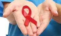 អាមេរិកជួយឧបត្ថម្ភទឹកប្រាក់ចំនួន២៦លានដុល្លារអាមេរិកដើម្បីបង្ការប្រឆាំង HIV នៅវៀតណាម