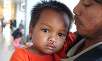 Opérations gratuites pour les enfants malformés de Ninh Thuan
