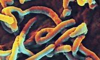 Ebola : Des Japonais annoncent un test de détection efficace en 30 minutes