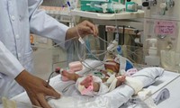 Successful congenital heart operation for premature baby