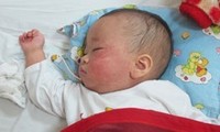 越南承诺2017年消灭麻疹