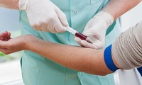 滴血测试可发现多种癌症