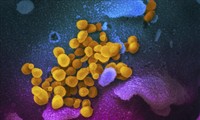 ВОЗ рассматривает письмо учёных, предупредивших о возможности передачи коронавируса по воздуху