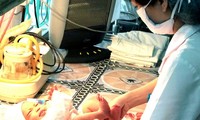 Ayuda japonesa para salud de madres e infantes en Dien Bien