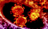 Virus MERS cobra 173 vidas en Arabia Saudita