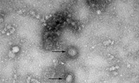จีนพบผู้ติดเชื้อไวรัสโคโรนาพันธุ์ใหม่เพิ่มหลายราย