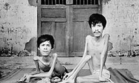 Triển lãm kỷ niệm 51 năm thảm họa da cam/dioxin Việt Nam