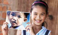 Công bố Quỹ Nụ cười với 500 suất mổ hàm ếch cho trẻ em Việt Nam