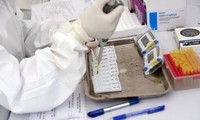 Во Вьетнаме подтверждены 12 новых случаев заражения коронавирусной инфекцией 