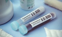 สหรัฐให้ความช่วยเหลือประเทศอาเซียนในการรับมือการแพร่ระบาดของโรคโควิด - 19