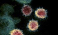 นักวิทยาศาสตร์เนเธอร์แลนด์ตรวจพบแอนติบอดียับยั้งเชื้อไวรัส  SARS-CoV-2