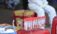 COVID-19: 77 domestically- transmitted infection cases reported on Sunday