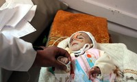 ONU pide ayuda por 3 mil millones de dólares para Yemen