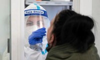 Detectan el primer caso de flurona en México
