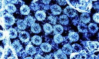 US CDC tracks new lineage of virus that causes COVID
