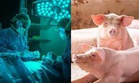 Le rein d'un porc transplanté avec succès sur un humain, une première mondiale 