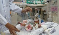 Детская больница №1 успешно сделала 5-ю в мире операцию пациенту с редким врожденным пороком сердца