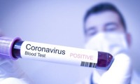 เวียดนามพบผู้ติดเชื้อไวรัส SARS-CoV-2 รายที่ 34 