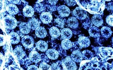 L’OMS et les États-Unis surveillent de près un nouveau variant du SARS-CoV-2