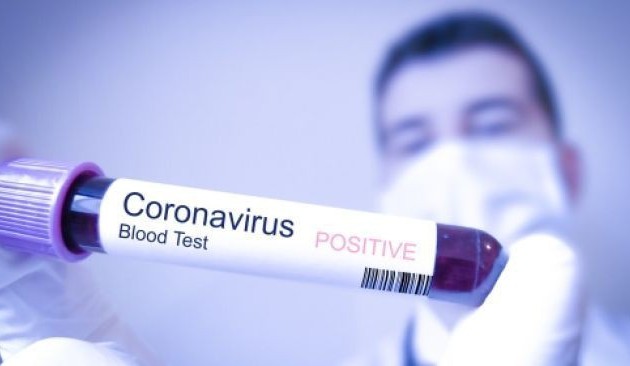 Wabah Covid-19: Di Vietnam ada  lagi tiga  kasus yang terinfeksi virus SARS-CoV-2 