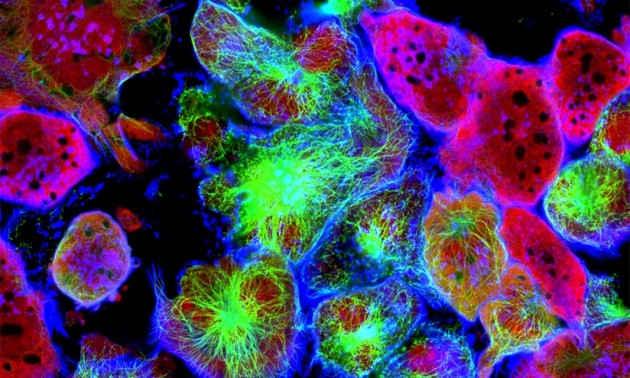 New study on factors behind cancer