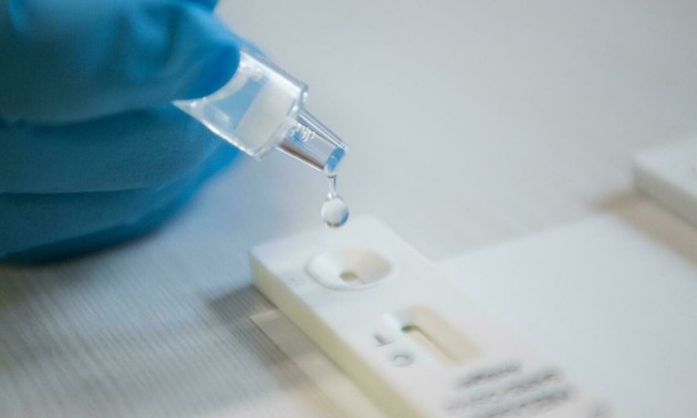 Les tests antigéniques moins sensibles à Omicron, selon les autorités sanitaires américaines