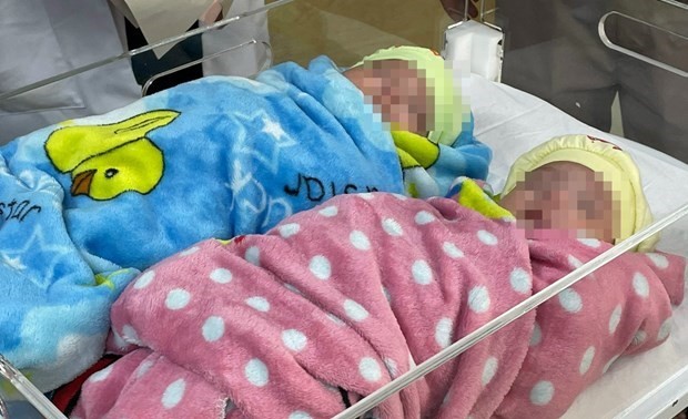 Twins survive after premature birth, weighing just 500g