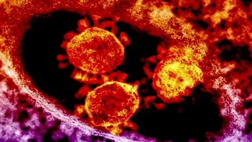 Virus MERS cobra 173 vidas en Arabia Saudita
