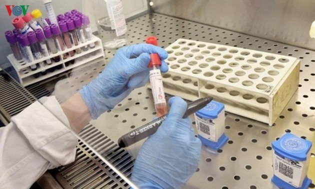 Vietnam estudia aplicación suplementaria de medicamento para VIH/SIDA en tratamiento de coronavirus