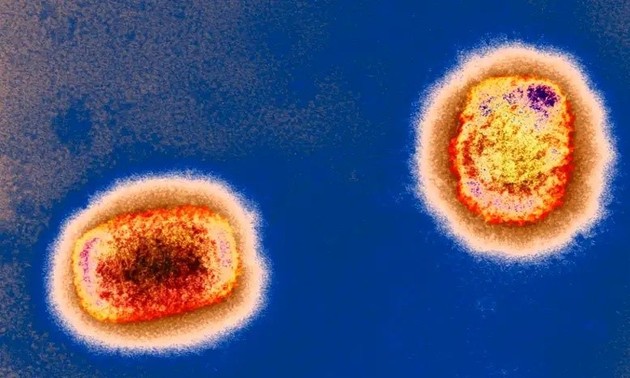 Vietnam se prepara activamente para prevenir la epidemia de viruela símica