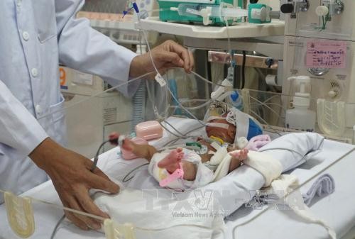 胡志明市第1儿童医院成功实施世界第5例先天性心脏畸形手术
