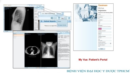 Prescription vue clearance