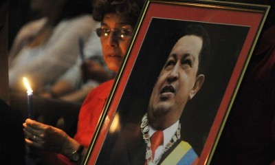 Chávez recibe tratamientos complementarios complejos y duros  - ảnh 1