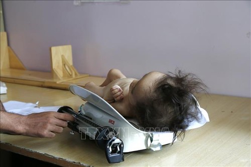 UNICEF呼吁解决儿童营养不良问题 - ảnh 1