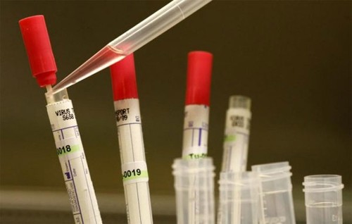 世卫组织批准给埃博拉患者使用新药 - ảnh 1