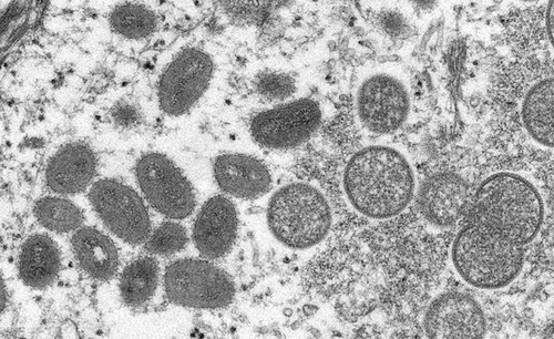 WHO 呼吁公众支持重新命名导致猴痘的病毒 - ảnh 1