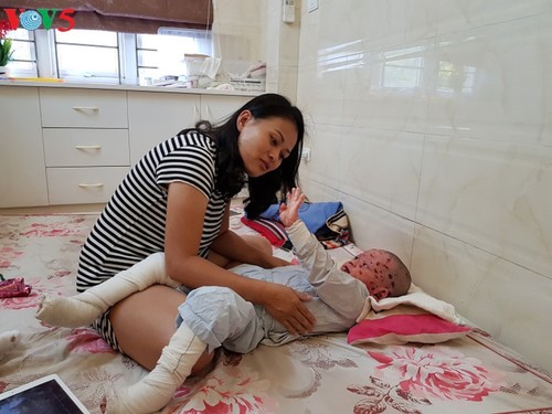 Hanoi’s mum brings hope to children with epidermolysis bullosa - ảnh 1
