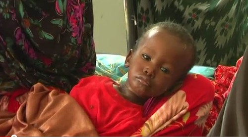 ONU ayuda a Somalia a luchar contra el cólera - ảnh 1