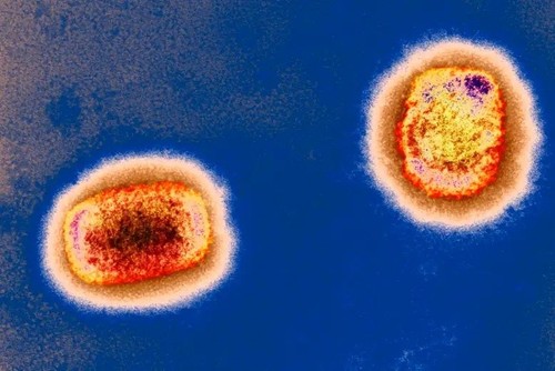 Vietnam se prepara activamente para prevenir la epidemia de viruela símica - ảnh 1