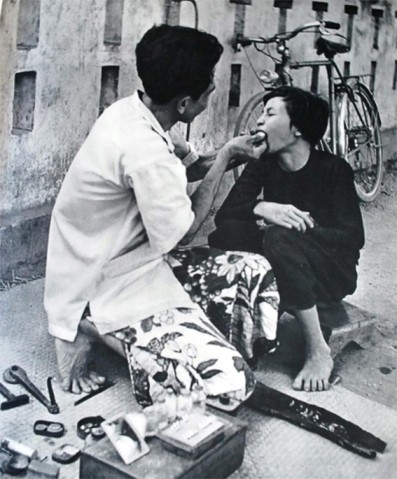 Black teeth: Vietnam's once hot beauty regimen  - ảnh 2