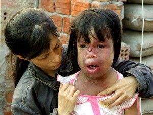 Víctimas de dioxina reciben donaciones de compatriotas en Tailandia - ảnh 1