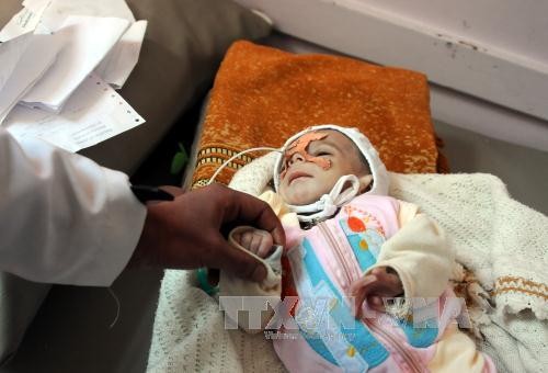 ONU pide ayuda por 3 mil millones de dólares para Yemen - ảnh 1