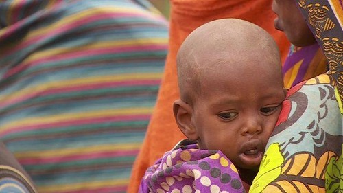 UN: Millions face hunger in Ethiopia - ảnh 1